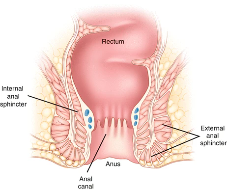 Medical diagram showing a coronal view of the rectum, anal canal, anus, internal anal sphincter, and external anal sphincter.